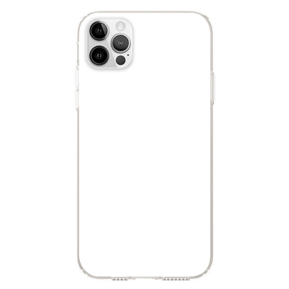 Lovely Peeking Dogs - Personalized Custom Phone Case