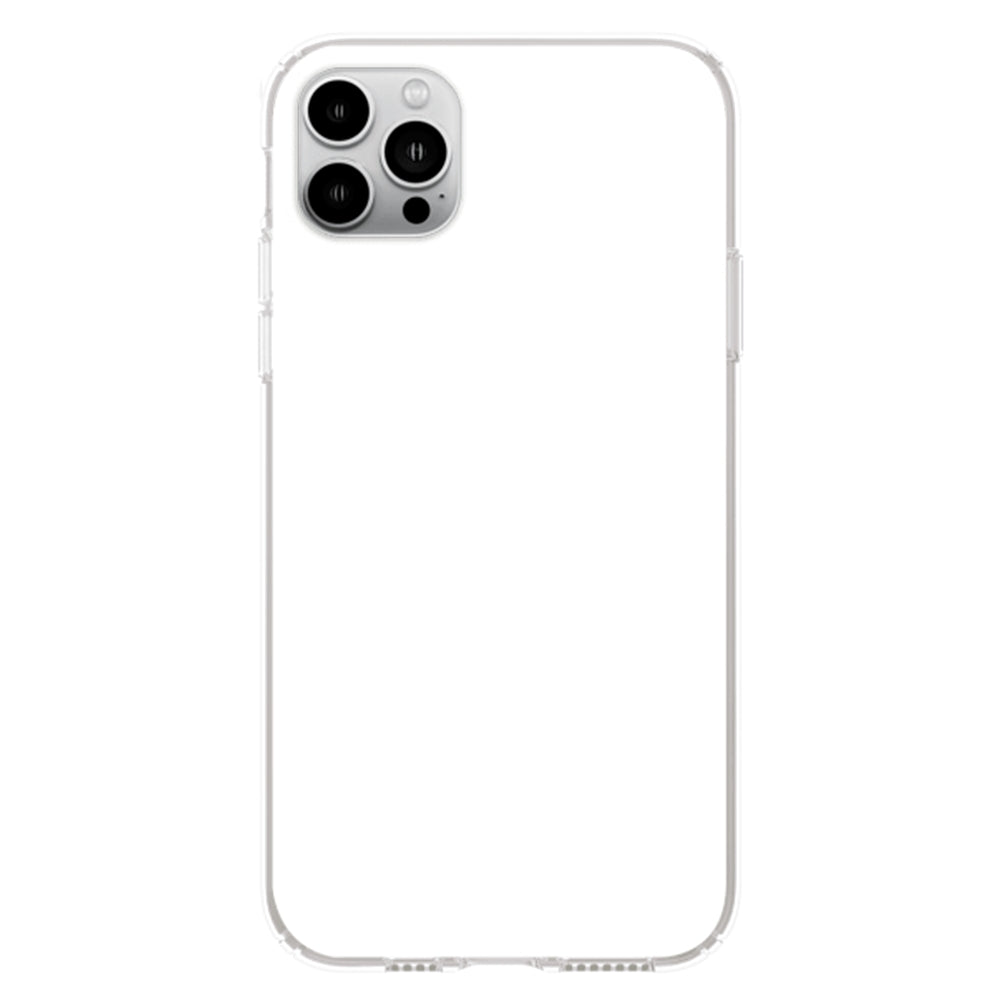 Lovely Peeking Dogs - Personalized Custom Phone Case